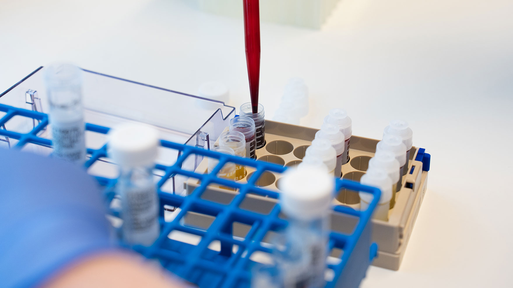 Sample proseccing in Biobank laboratory 